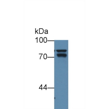 Anti-Beta Catenin (Beta-catenin) Human Monoclonal Antibody