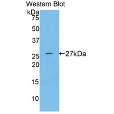 Anti-Transferrin Receptor (TFR) Human Polyclonal Antibody