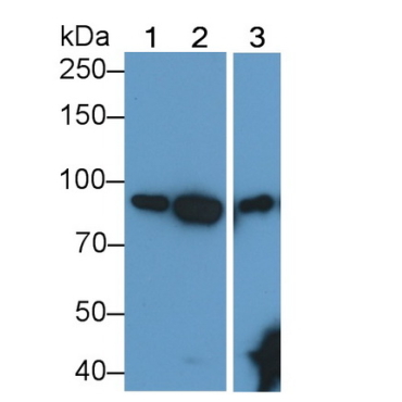 Anti-Transferrin Receptor (TFR) Human Monoclonal Antibody