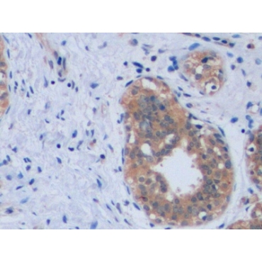 Anti-Transferrin Receptor (TFR) Human Monoclonal Antibody