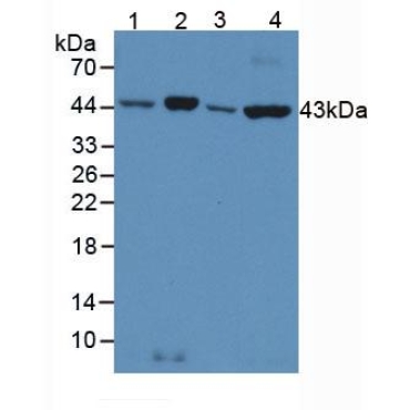 Anti-Beta Actin (ACTB) Human Polyclonal Antibody
