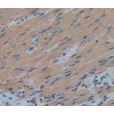 Anti-Actin Alpha 1, Cardiac Muscle (ACTC1) Human Polyclonal Antibody