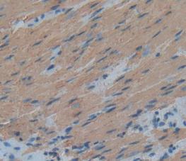 Anti-Actin Alpha 1, Cardiac Muscle (ACTC1) Human Polyclonal Antibody