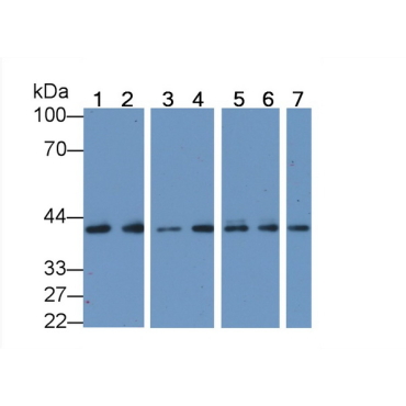Anti-Actin Alpha 1, Cardiac Muscle (ACTC1) Human Monoclonal Antibody