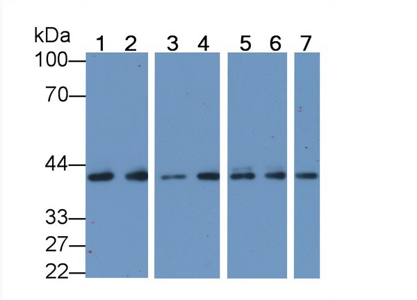Anti-Actin Alpha 1, Cardiac Muscle (ACTC1) Human Monoclonal Antibody