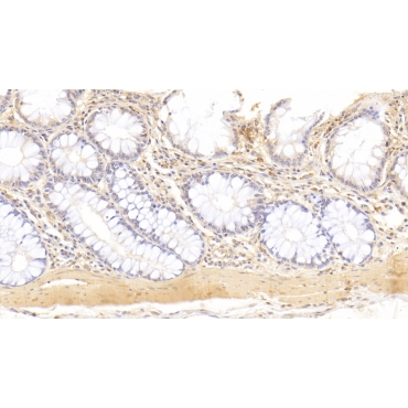 Anti-Actin Alpha 2, Smooth Muscle (ACTa2) Human Monoclonal Antibody