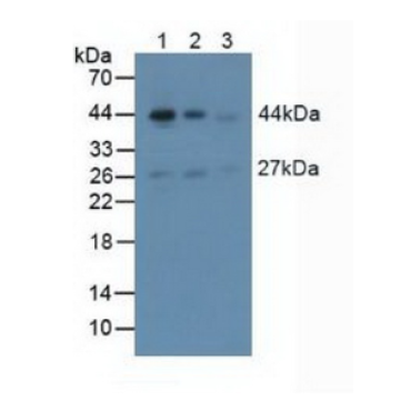 Anti-Actin Alpha 2, Smooth Muscle (ACTa2) Human Polyclonal Antibody