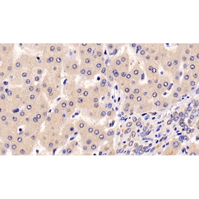 Anti-Extracellular Signal Regulated Kinase 1 (ERK1) Human Monoclonal Antibody