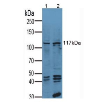 Anti-Vinculin (VCL) Human Polyclonal Antibody