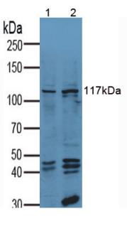 Anti-Vinculin (VCL) Human Polyclonal Antibody