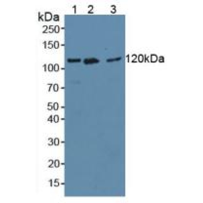 Anti-Vinculin (VCL) Human Monoclonal Antibody