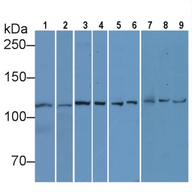 Human, Mouse, Rat Anti-Vinculin (VCL) Monoclonal Antibody