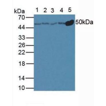 Anti-Tubulin Beta (TUBb) Human Polyclonal Antibody