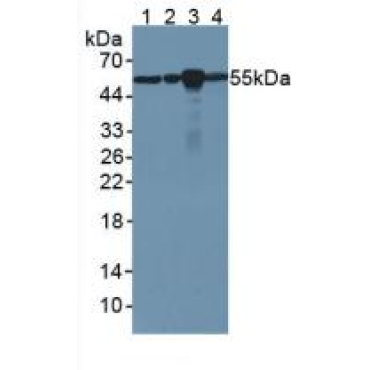 Anti-Tubulin Beta (TUBb) Human Monoclonal Antibody