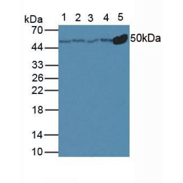 Anti-Tubulin Beta (TUBb) Human Polyclonal Antibody