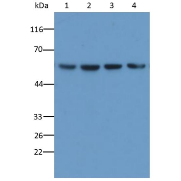 Human, Mouse, Rat Anti-Tubulin Beta (TUBb) Monoclonal Antibody