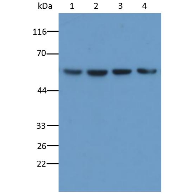 Human, Mouse, Rat Anti-Tubulin Beta (TUBb) Monoclonal Antibody