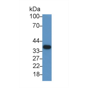 Anti-Glyceraldehyde-3-Phosphate Dehydrogenase (GAPDH) Human Monoclonal Antibody