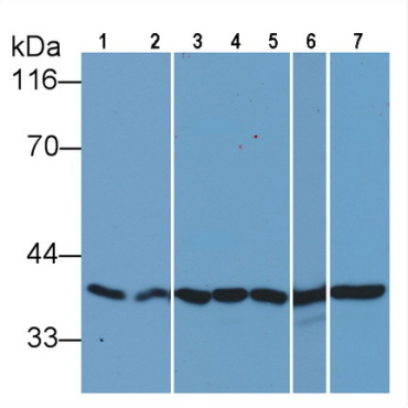 Human, Mouse, Rat Anti-Glyceraldehyde-3-Phosphate Dehydrogenase (GAPDH) Monoclonal Antibody
