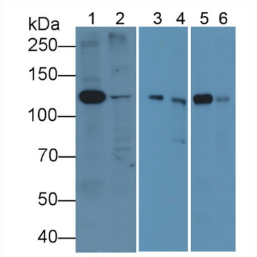 Anti-Platelet Derived Growth Factor Receptor Alpha (PDGFRa) Human Polyclonal Antibody