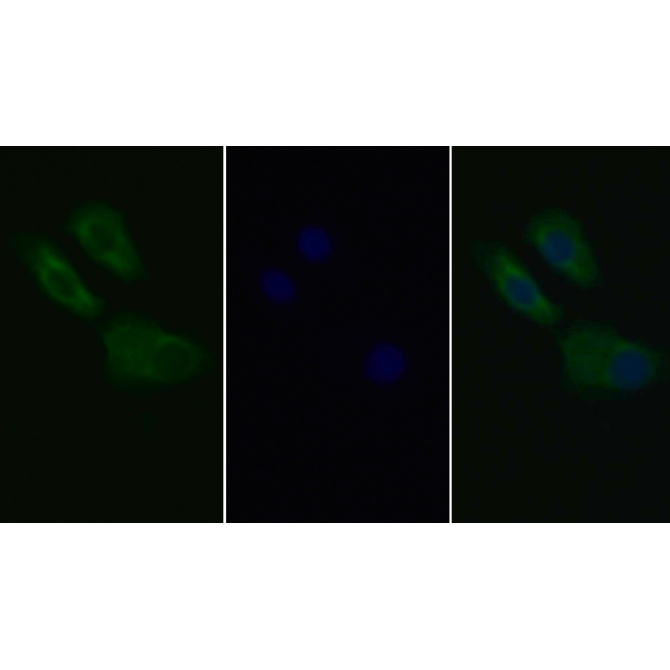 Anti-Platelet Derived Growth Factor Receptor Alpha (PDGFRa) Human Monoclonal Antibody
