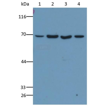 Anti-Lamin B1 (LMNB1) Human Monoclonal Antibody