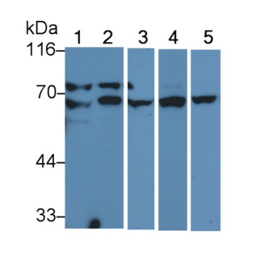 Anti-Lamin A/C (LMNA) Human Monoclonal Antibody
