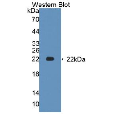 Anti-ATPase, Na+/K+ Transporting Alpha 1 Polypeptide (ATP1a1) Human Polyclonal Antibody