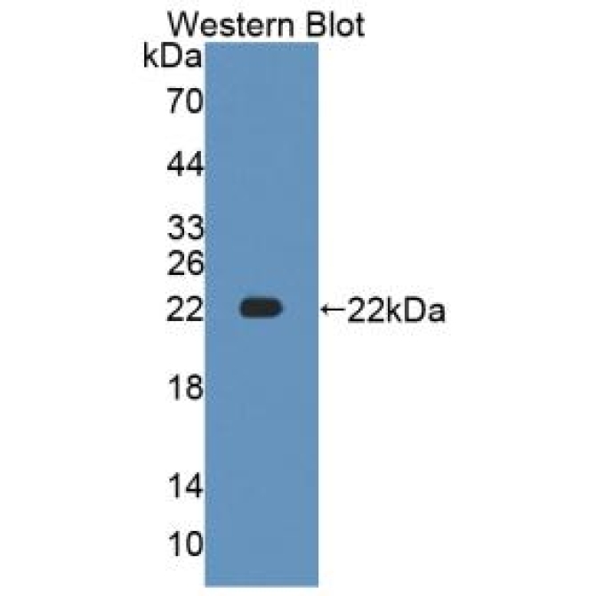 Anti-ATPase, Na+/K+ Transporting Alpha 1 Polypeptide (ATP1a1) Human Polyclonal Antibody