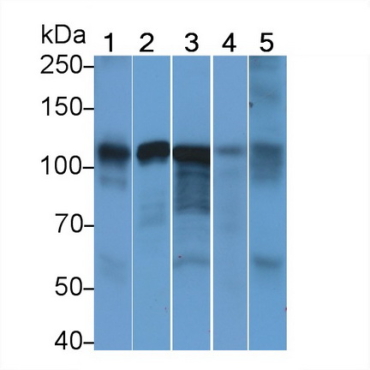 Anti-ATPase, Na+/K+ Transporting Alpha 1 Polypeptide (ATP1a1) Human Monoclonal Antibody