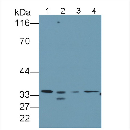 Anti-Voltage Dependent Anion Channel Protein 1 (VDAC1) Human Polyclonal Antibody