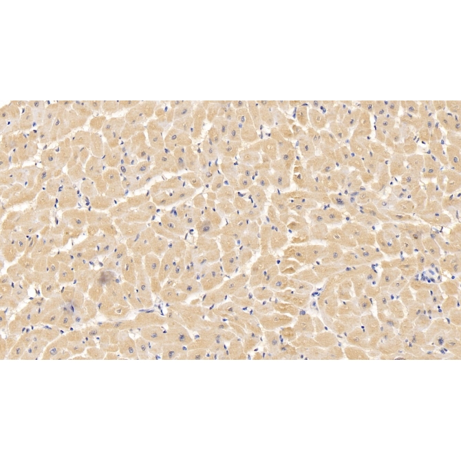 Anti-Voltage Dependent Anion Channel Protein 1 (VDAC1) Human Monoclonal Antibody