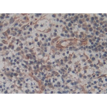 Amphiregulin (AREG) Human Biotin-Linked Monoclonal Antibody