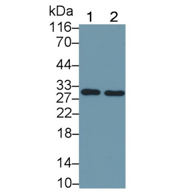 FMS Like Tyrosine Kinase 3 Ligand (Flt3L) Human HRP-Linked Monoclonal Antibody