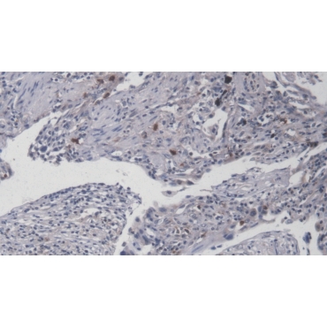 Interleukin 8 (IL8) Human FITC-Linked Monoclonal Antibody