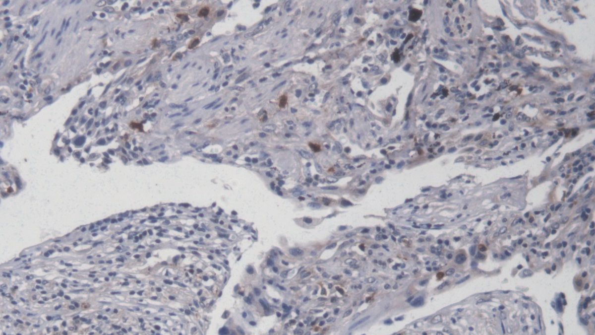 Interleukin 8 (IL8) Human FITC-Linked Monoclonal Antibody