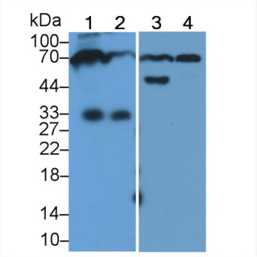 Immunoglobulin M (IgM) Human HRP-Linked Polyclonal Antibody