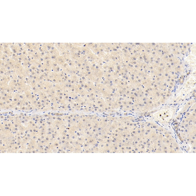 Chemerin (CHEM) Human APC-Linked Monoclonal Antibody