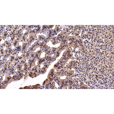 Activated Leukocyte Cell Adhesion Molecule (ALCAM) Human Monoclonal Antibody