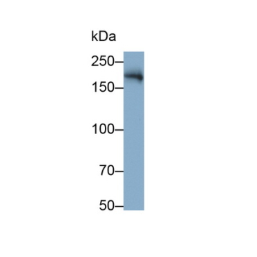 Angiotensin I Converting Enzyme (ACE) Human Monoclonal Antibody