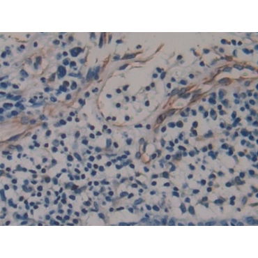 Amphiregulin (AREG) Human Monoclonal Antibody
