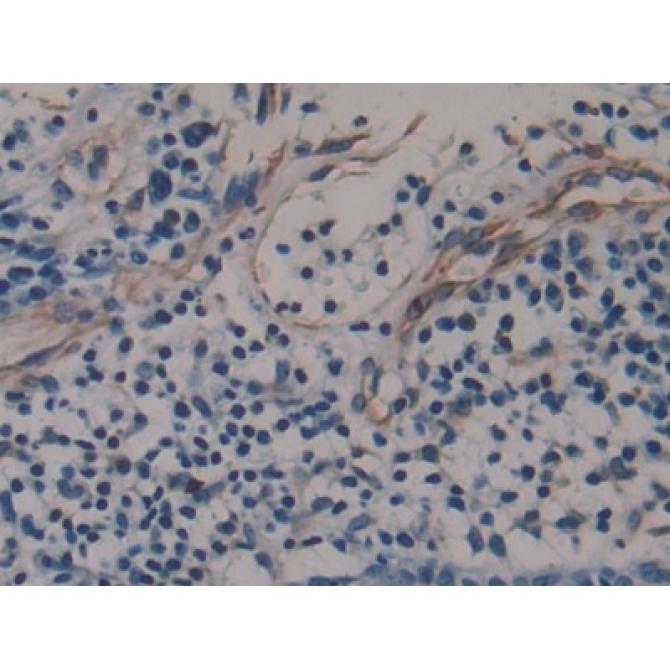 Amphiregulin (AREG) Human Monoclonal Antibody