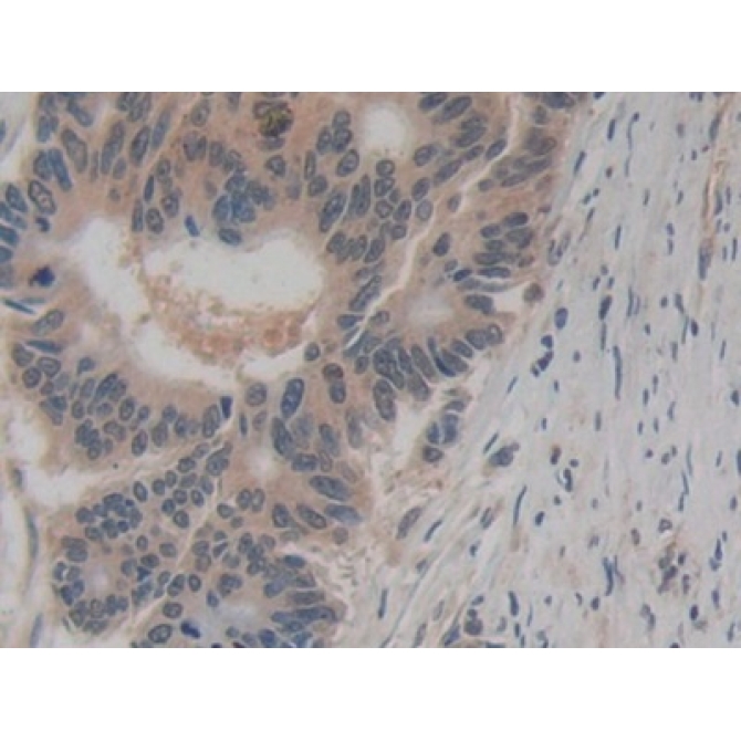 Amphiregulin (AREG) Human Monoclonal Antibody