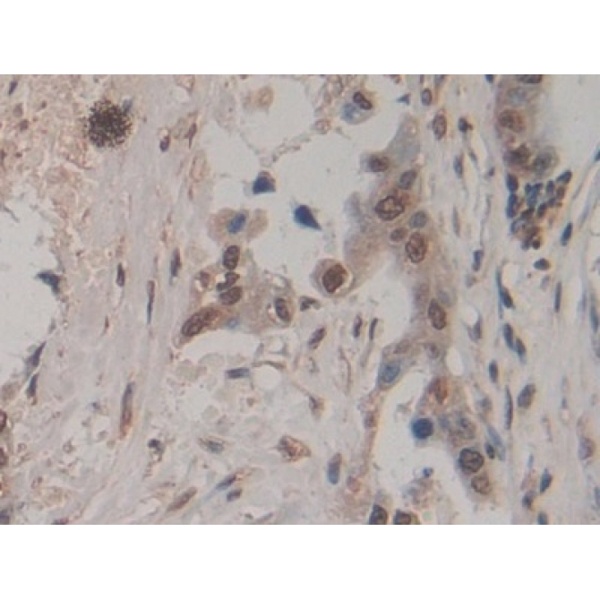 Amphiregulin (AREG) Human Monoclonal Antibody