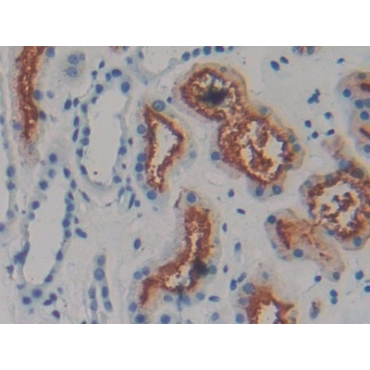 Amphiregulin (AREG) Human Monoclonal Antibody