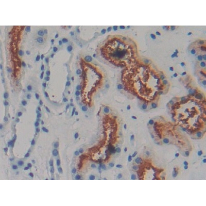 Amphiregulin (AREG) Human Monoclonal Antibody