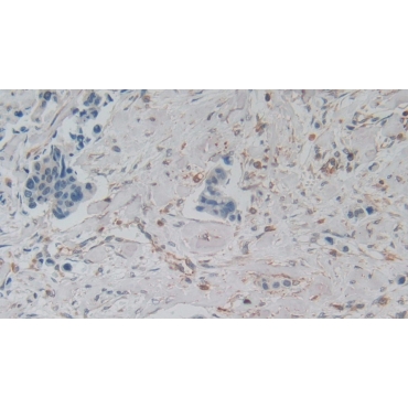 Amphiregulin (AREG) Human Monoclonal Antibody
