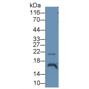 Angiogenin (ANG) Human Monoclonal Antibody