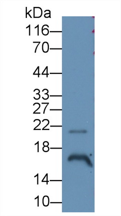 Angiogenin (ANG) Human Monoclonal Antibody