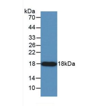Angiogenin (ANG) Human Monoclonal Antibody